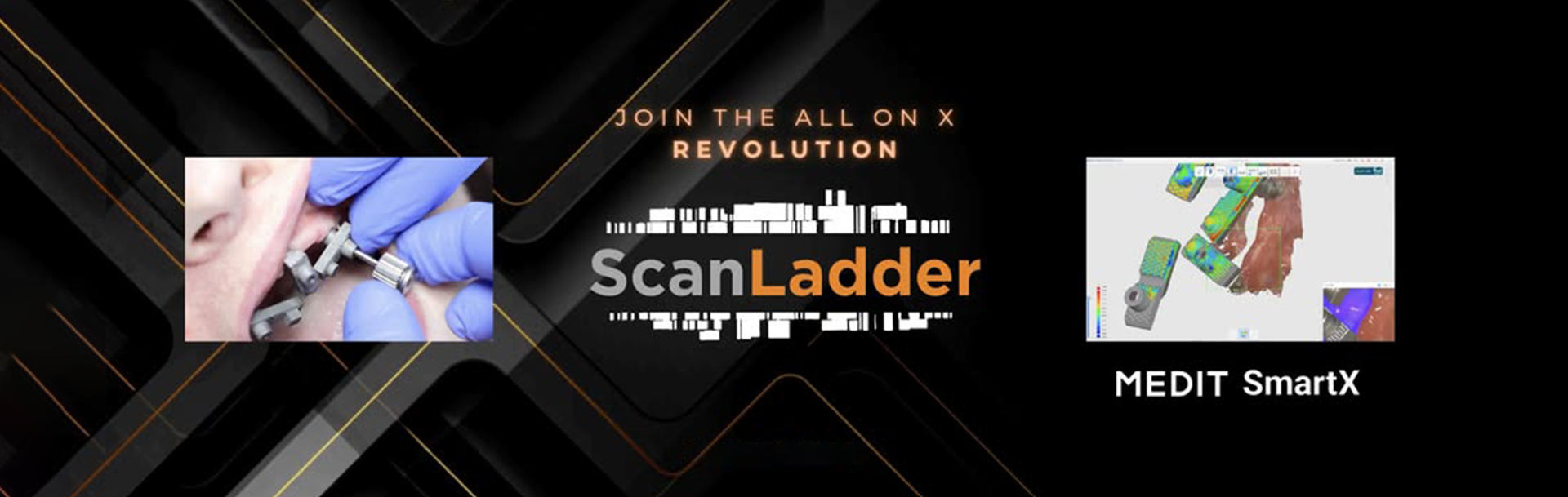 implant-solution-scanladder-banner