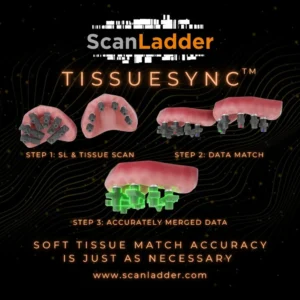 Scan Ladder Tissue Sync