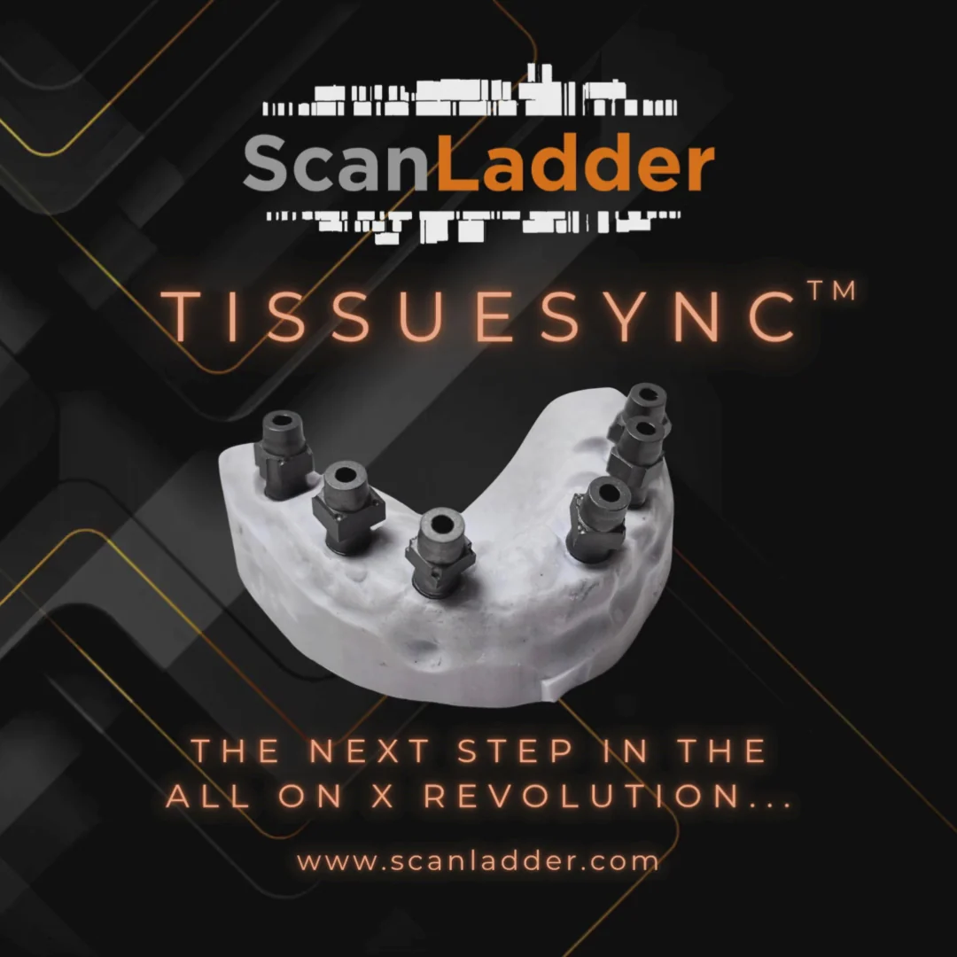 Scan Ladder Tissue Sync - Image 2